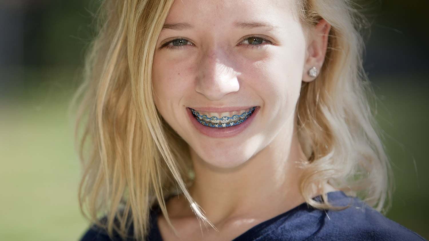 Ford orthodontics colorado #6